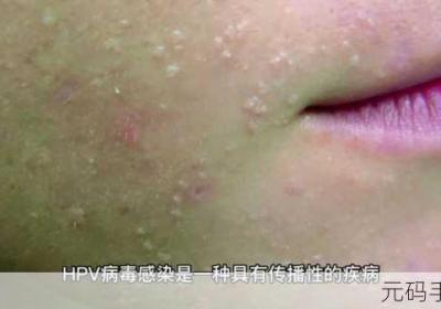 HPV感染和性接触关系分析 hpv感染和性生活有关系吗