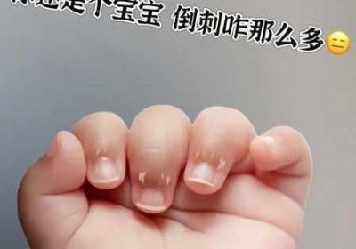宝宝才两根手指就哭了 宝宝才两根手指就痛了?