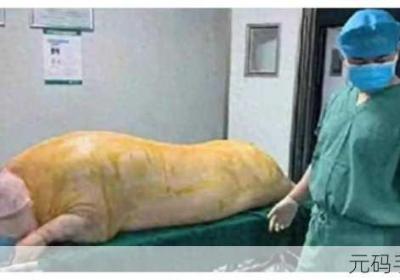 人和猪CROPROATION 人和猪的基因相似度99%