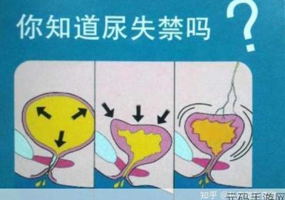戴上尿锁不能尿知乎 戴尿管 尿不出来 堵了怎么办